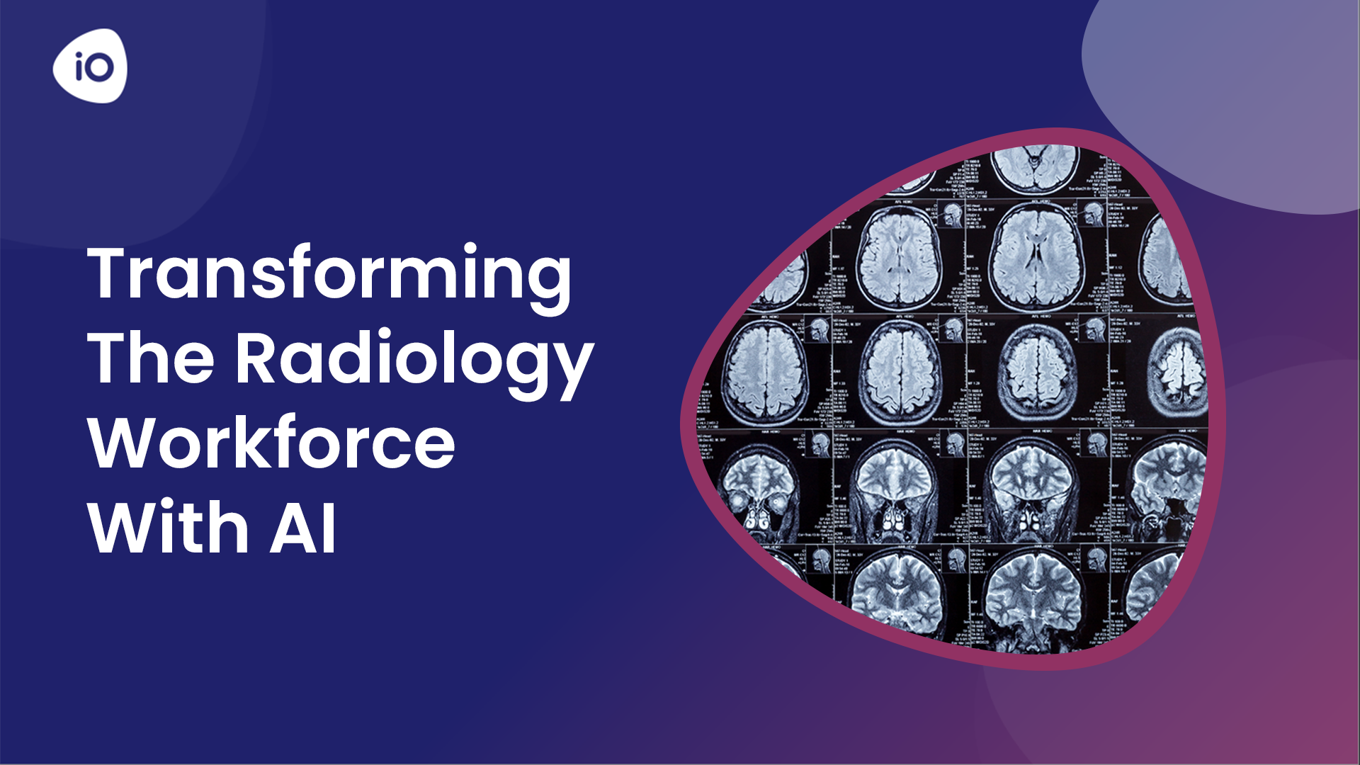 Transforming the Radiology Workforce using AI